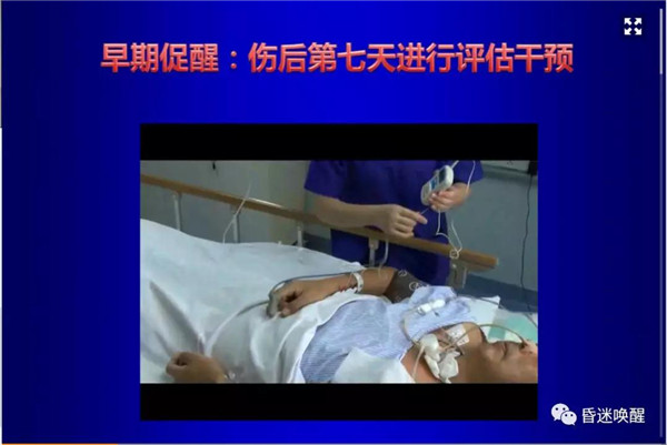 右正中電刺激|簡單實(shí)用的昏迷早期促醒新技術(shù)