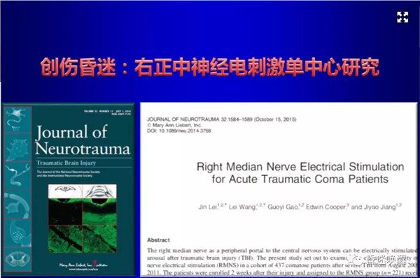 右正中電刺激|簡單實(shí)用的昏迷早期促醒新技術(shù)